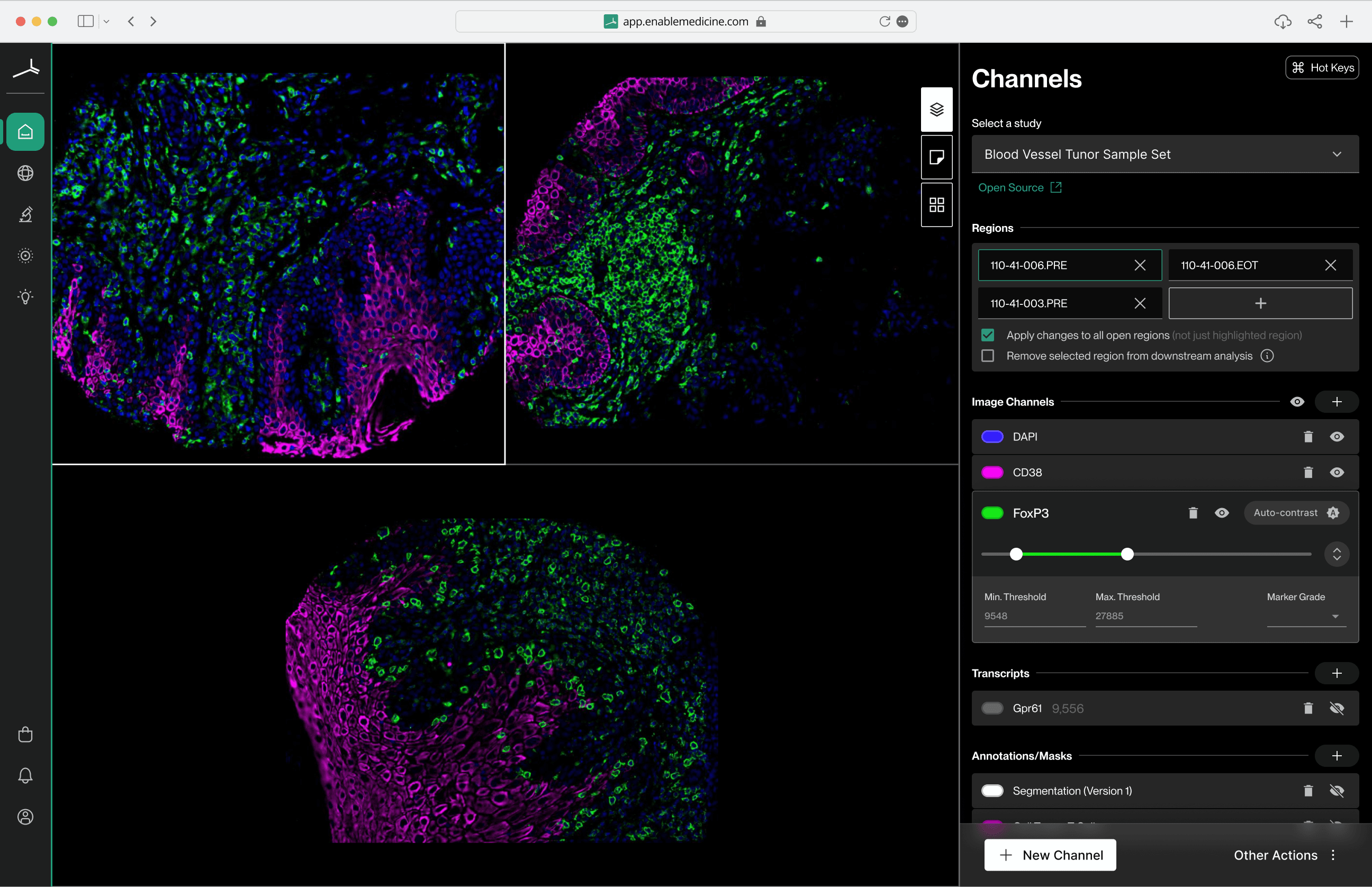 Visualizer — channels panel