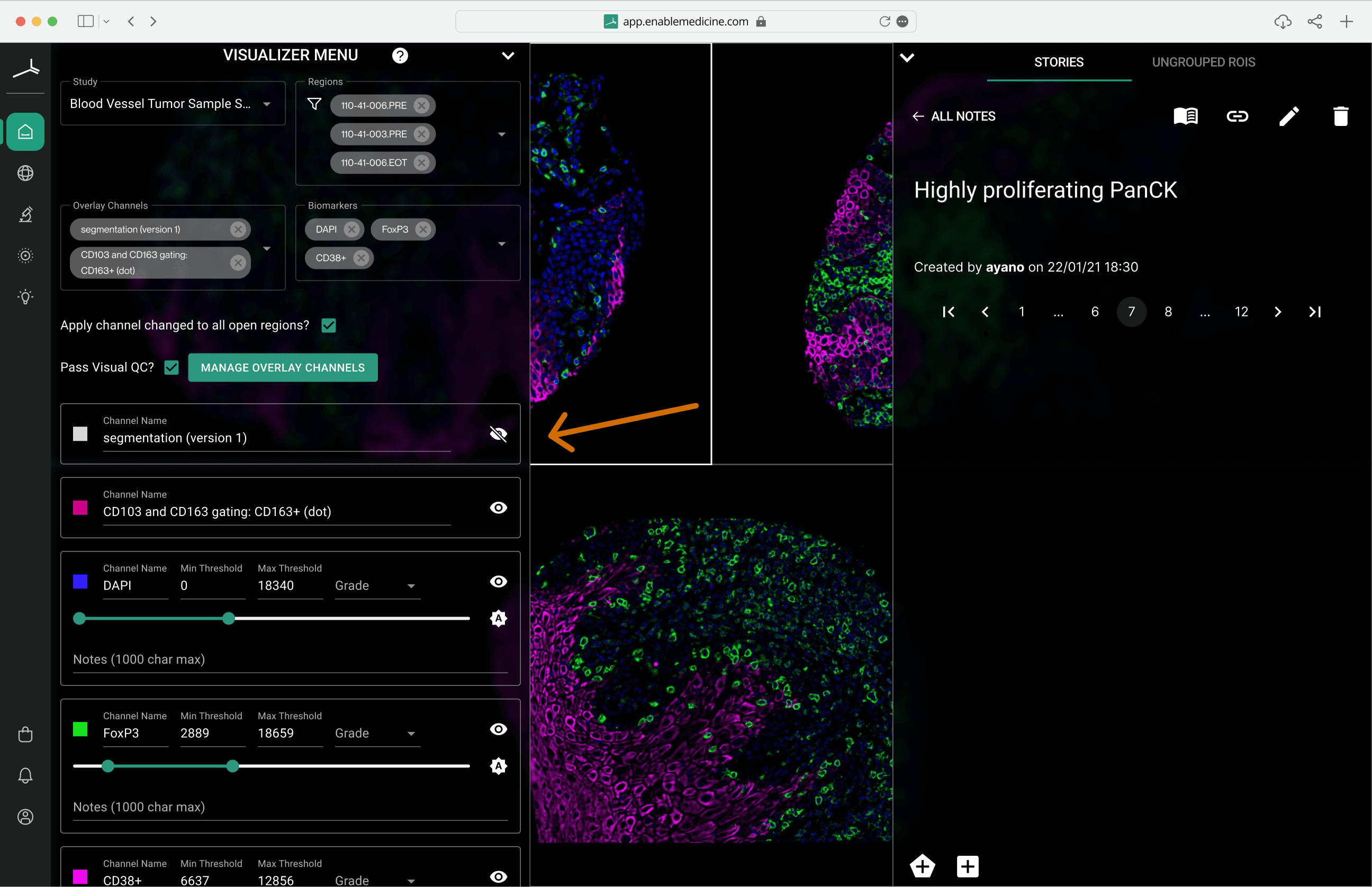Visualizer — channels panel, hover to view the canvas