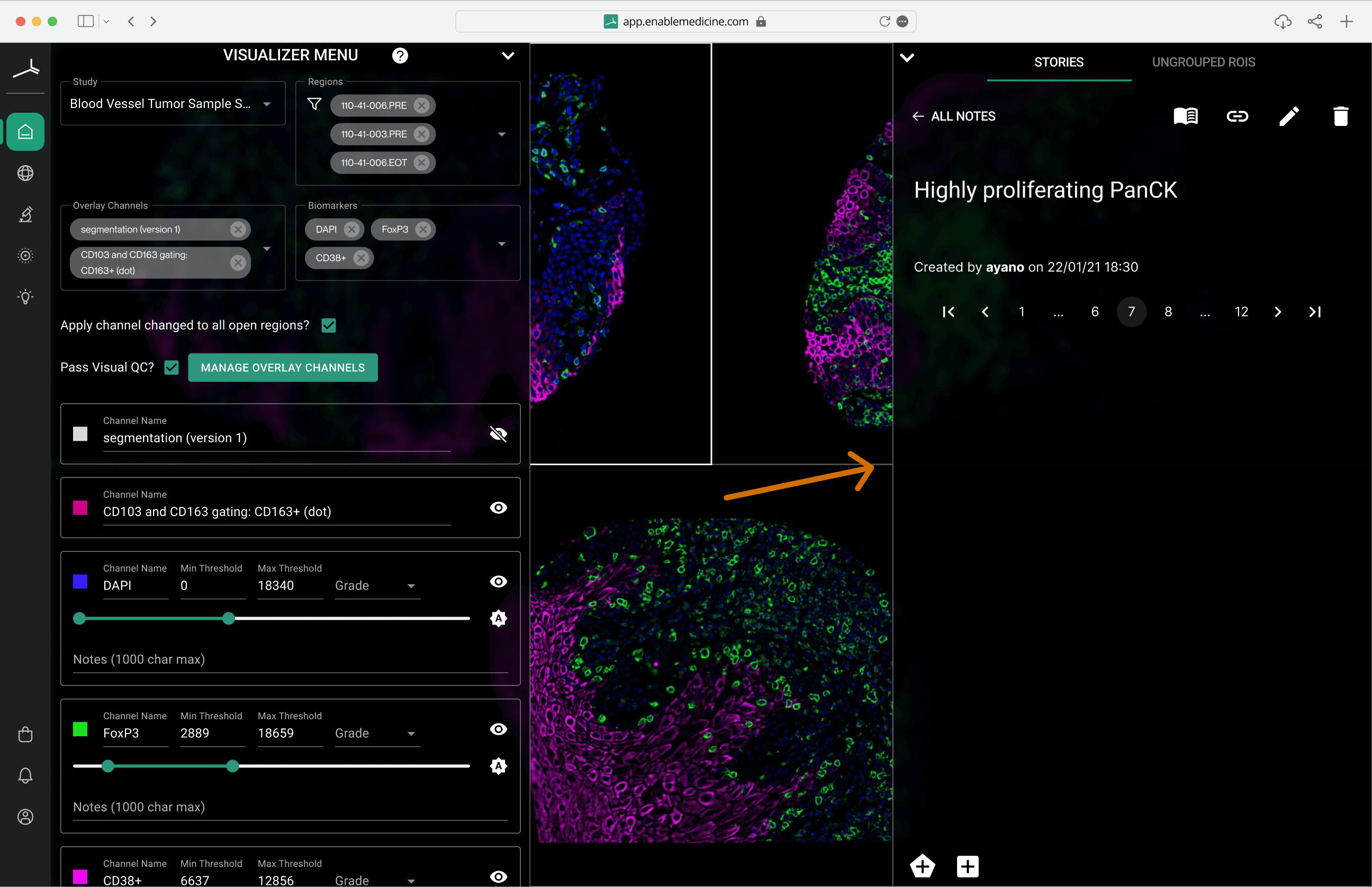 Visualizer — stories panel, hover to view the canvas