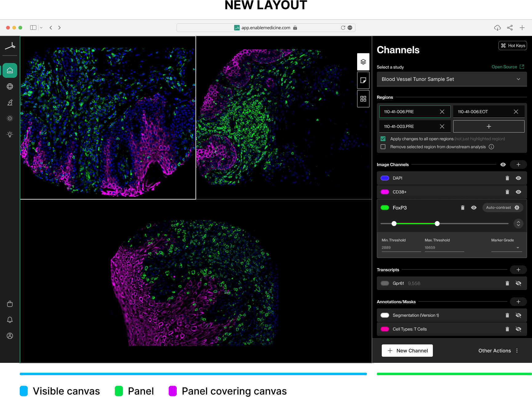 The new Visualizer canvas
