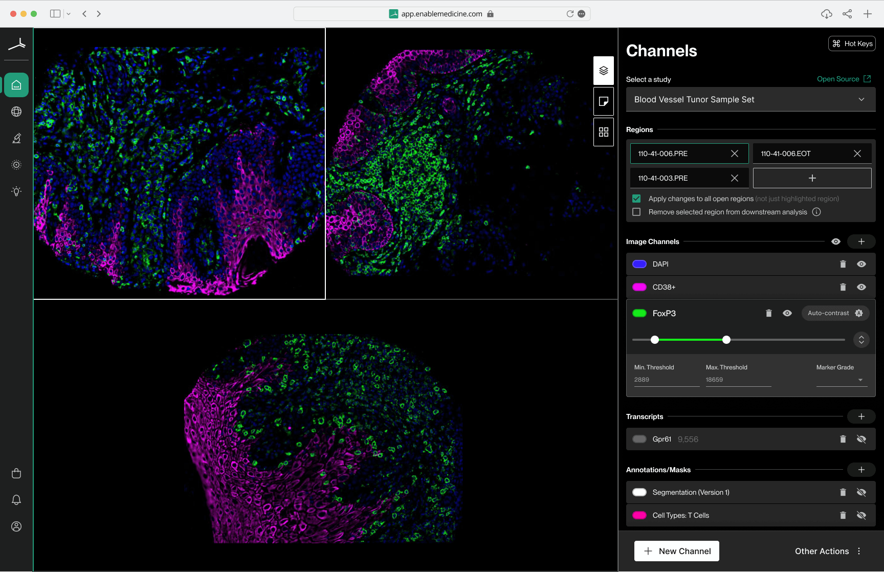 The updated Visualizer UI