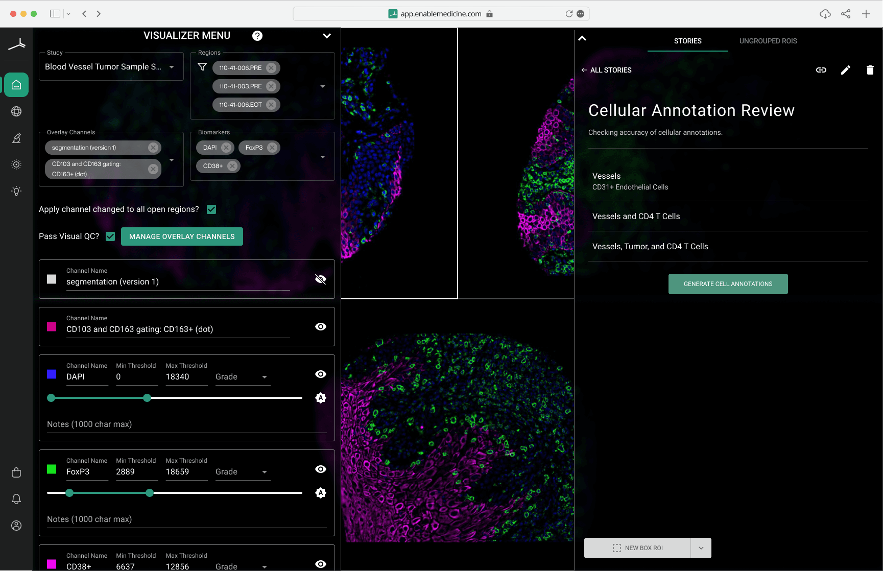 The original Visualizer UI