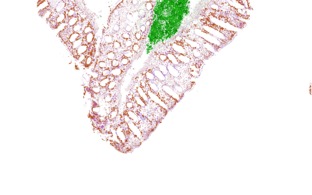 Visualizer — a histology biomarker viewer